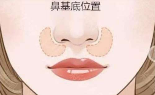 垫鼻基底1.jpg