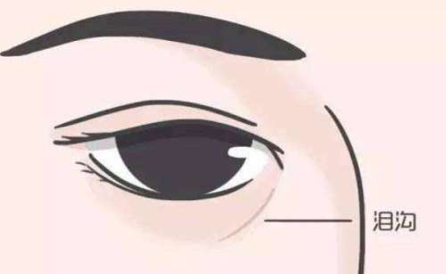 泪沟2.jpg