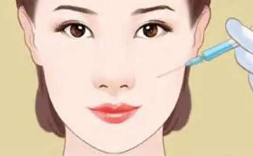 玻尿酸1.jpg