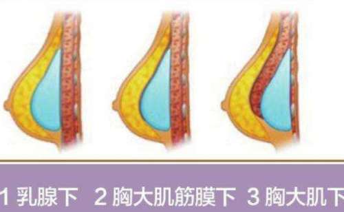 胸.jpg