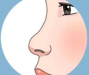 隆鼻dm01.jpg 隆鼻dm01.jpg