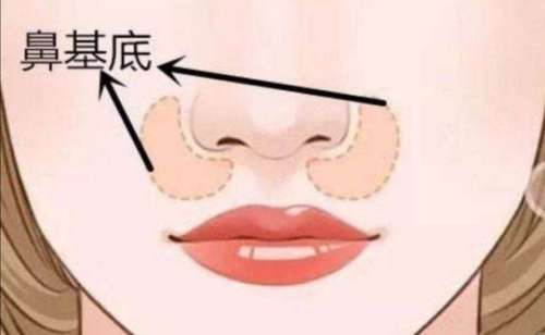 法令纹1.jpg