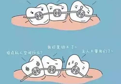 牙齿矫正5.jpg