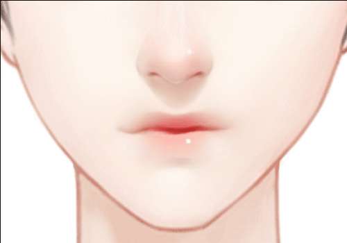 W-LINE瓜子脸手术.jpg