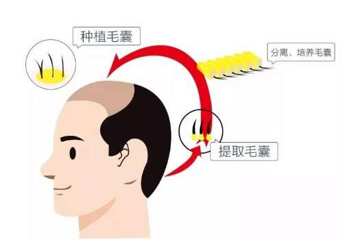 头发 (5).jpg