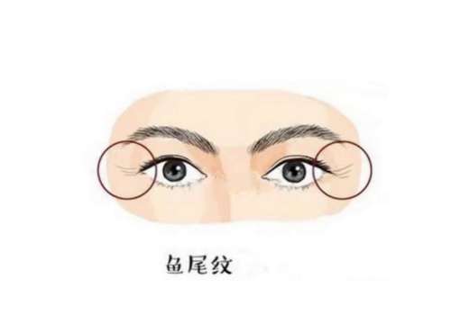 鱼尾纹2.jpg