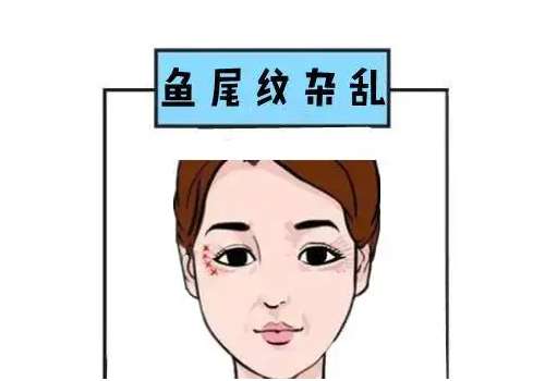 鱼尾纹1.jpg