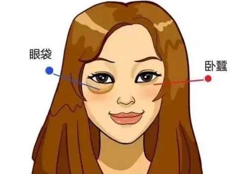 眼袋5.jpg