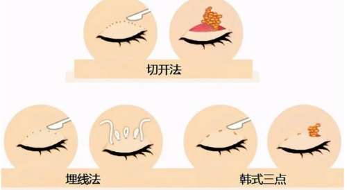 ˫Ƥ