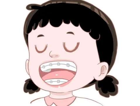 牙齿矫正2.jpg
