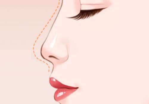 鼻子 (1).jpg