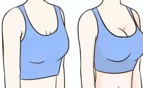 假体隆胸动漫2.jpg