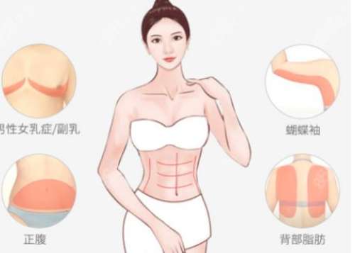 蝴蝶袖吸脂4.jpg