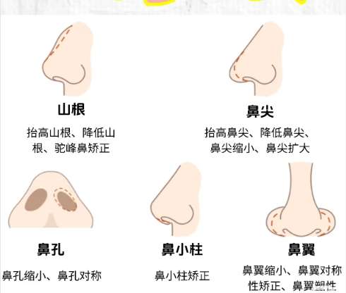 隆鼻 隆鼻