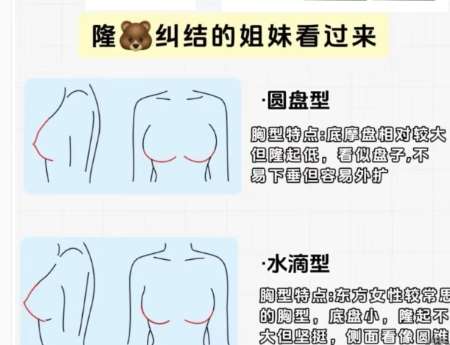 隆胸 隆胸