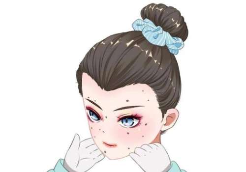 痣3.jpg