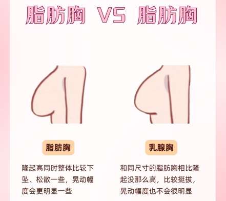 隆胸 隆胸