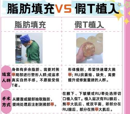 隆胸 隆胸