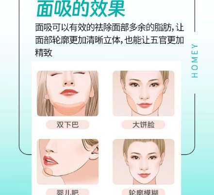 面部吸脂 面部吸脂
