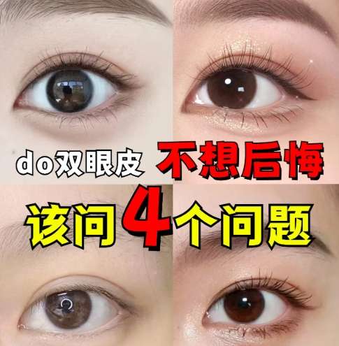双眼皮 双眼皮
