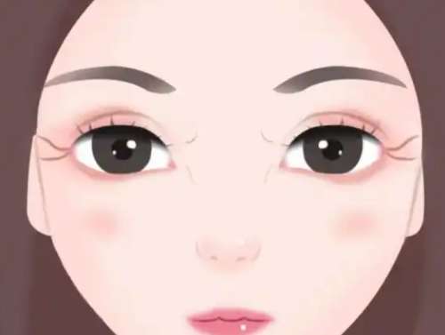 双眼皮dm12.jpg
