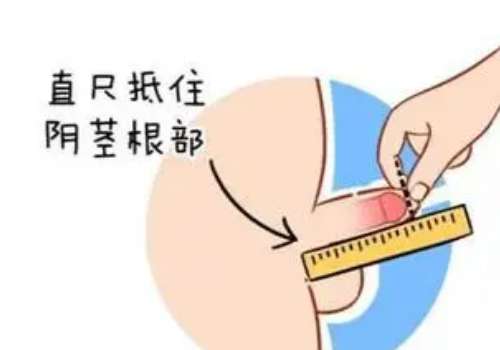 阴茎0.jpg