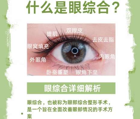 双眼皮 双眼皮