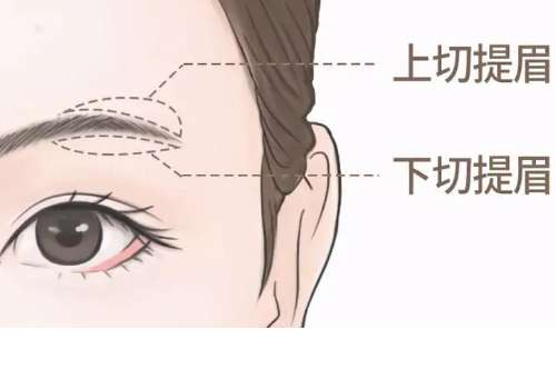提眉.jpg