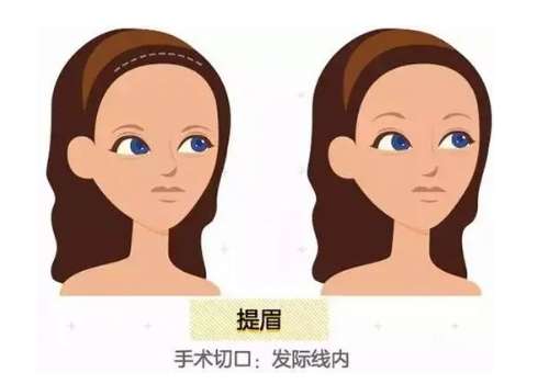 提眉00.jpg