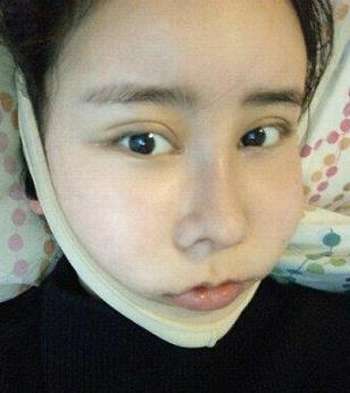 下颌角56788.jpg
