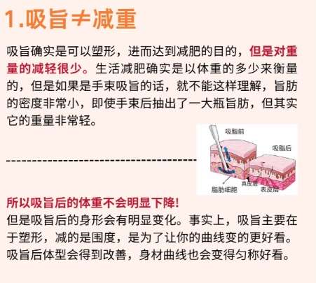 吸脂 吸脂