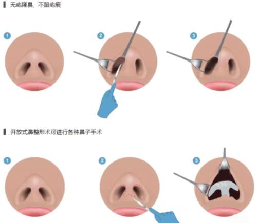 鼻子18.jpg