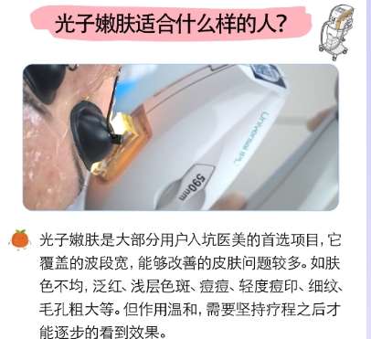 光子嫩肤 光子嫩肤