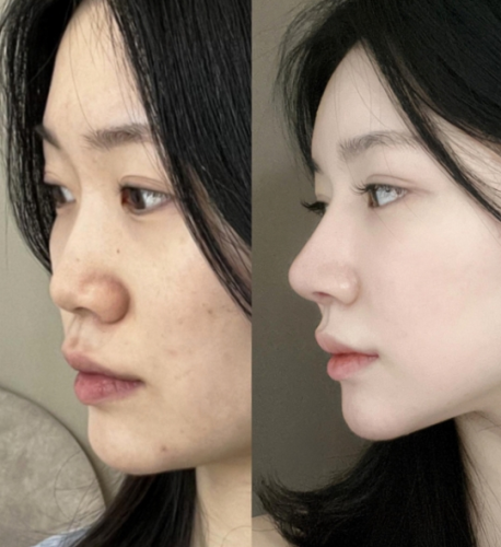 vx截图_20250818162017.png