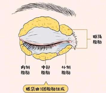 眼袋 眼袋
