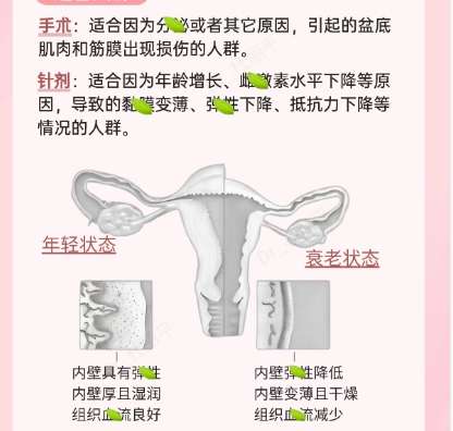 私密缩紧 私密缩紧