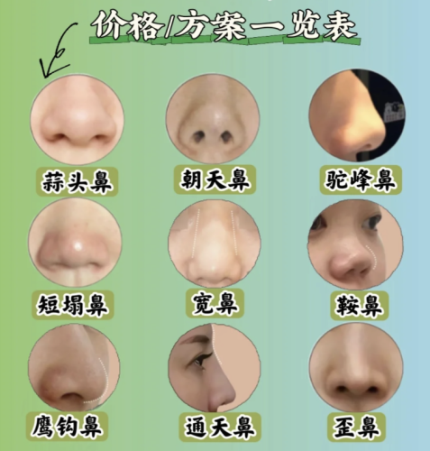 截屏2025-08-22 22.39.35.png