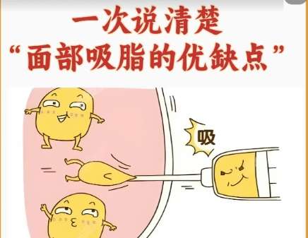 吸脂 吸脂