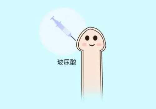 男性私密整形2.jpg