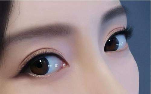 双眼皮 (4).jpg