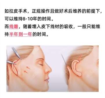 拉皮 拉皮