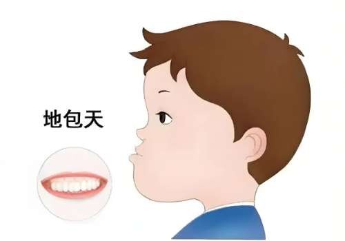 地包天12.jpg