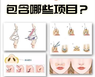 隆鼻 隆鼻