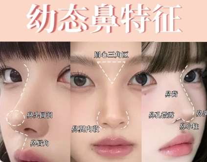 隆鼻 隆鼻