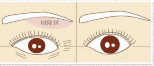 提眉动漫图03.jpg