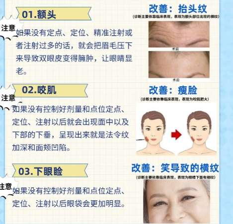 除皱 除皱