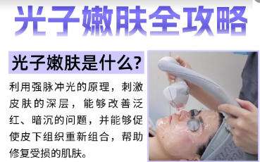 光子嫩肤 光子嫩肤
