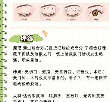 双眼皮 双眼皮