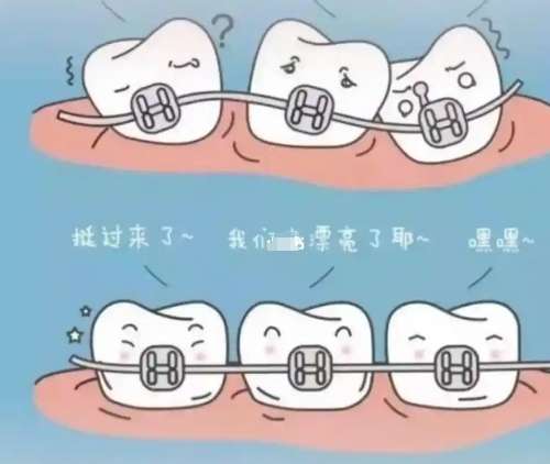 牙齿矫正dm4.jpg