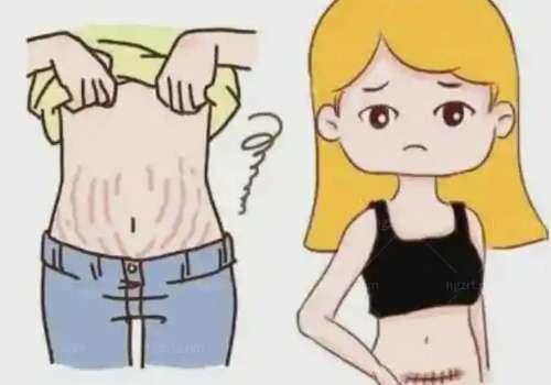 腹壁3.jpg